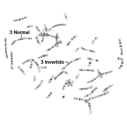 célula en metafase con inversión en cromosoma 3