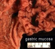 gastric mucose