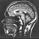 MRI scan of the head of a human 