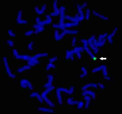 Sonda de cromosoma 4qter